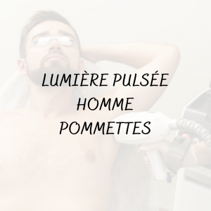 Épilation Lumière pulsée Homme <br/> Pommettes